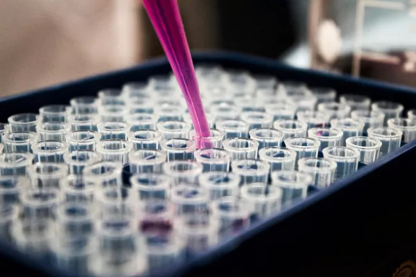 В Мордовии с начала года Управлением Россельхознадзора отобрано более 80 проб животноводческой продукции для проведения лабораторных исследований